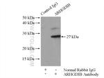 ARHGDIB Antibody in Immunoprecipitation (IP)