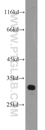 PHYHD1 Antibody in Western Blot (WB)