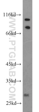 PHYHD1 Antibody in Western Blot (WB)