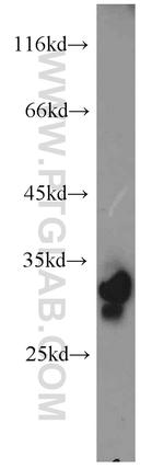 PHYHD1 Antibody in Western Blot (WB)