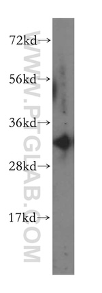 PHYHD1 Antibody in Western Blot (WB)