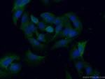 PGAM1 Antibody in Immunocytochemistry (ICC/IF)