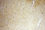 PGAM1 Antibody in Immunohistochemistry (Paraffin) (IHC (P))