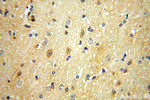 PGAM1 Antibody in Immunohistochemistry (Paraffin) (IHC (P))