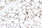 CLMP Antibody in Immunohistochemistry (Paraffin) (IHC (P))