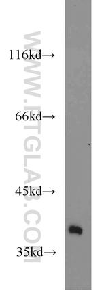 FDPS Antibody in Western Blot (WB)