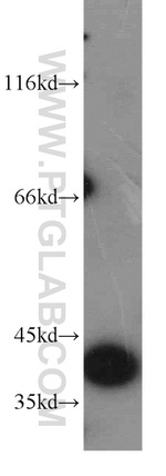 FDPS Antibody in Western Blot (WB)