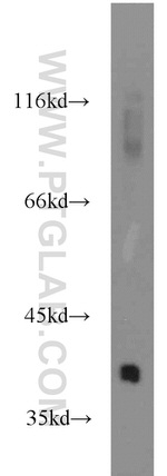 FDPS Antibody in Western Blot (WB)