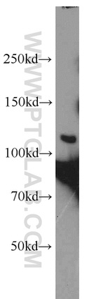 INTS4 Antibody in Western Blot (WB)