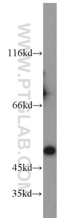 Citrate synthase Antibody in Western Blot (WB)