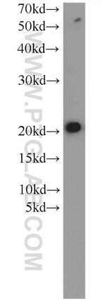 ITPA Antibody in Western Blot (WB)