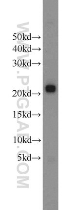 ITPA Antibody in Western Blot (WB)