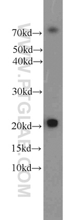 ITPA Antibody in Western Blot (WB)