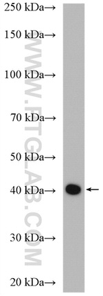 UBXN1 Antibody in Western Blot (WB)