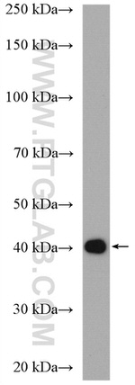 UBXN1 Antibody in Western Blot (WB)