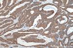 LAD1 Antibody in Immunohistochemistry (Paraffin) (IHC (P))