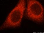 CAB39L Antibody in Immunocytochemistry (ICC/IF)
