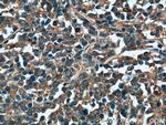 CAB39L Antibody in Immunohistochemistry (Paraffin) (IHC (P))