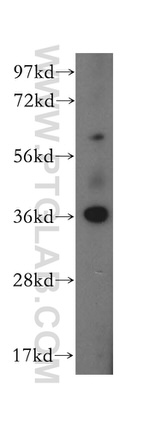 CAB39L Antibody in Western Blot (WB)