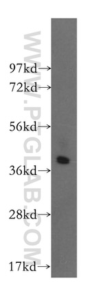 CAB39L Antibody in Western Blot (WB)