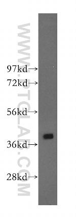CAB39L Antibody in Western Blot (WB)