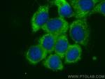 PCBP3 Antibody in Immunocytochemistry (ICC/IF)