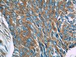 MRPL53 Antibody in Immunohistochemistry (Paraffin) (IHC (P))