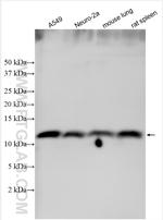 PSENEN Antibody in Western Blot (WB)
