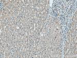 LYPLAL1 Antibody in Immunohistochemistry (Paraffin) (IHC (P))