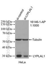 LYPLAL1 Antibody in Western Blot (WB)