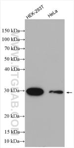 LYPLAL1 Antibody in Western Blot (WB)