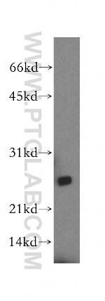 LYPLAL1 Antibody in Western Blot (WB)