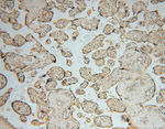 SMYD1 Antibody in Immunohistochemistry (Paraffin) (IHC (P))