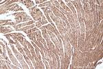 SMYD1 Antibody in Immunohistochemistry (Paraffin) (IHC (P))