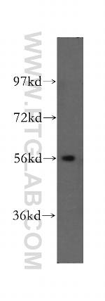 SMYD1 Antibody in Western Blot (WB)