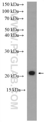 KRAS-2A Antibody in Western Blot (WB)