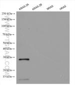 KRAS-2A Antibody in Western Blot (WB)