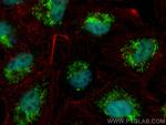ZMIZ1 Antibody in Immunocytochemistry (ICC/IF)