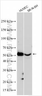 ZMIZ1 Antibody in Western Blot (WB)