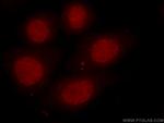 HDAC1 Antibody in Immunocytochemistry (ICC/IF)