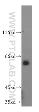 HDAC1 Antibody in Western Blot (WB)