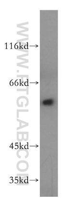 HDAC1 Antibody in Western Blot (WB)