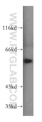 HDAC1 Antibody in Western Blot (WB)