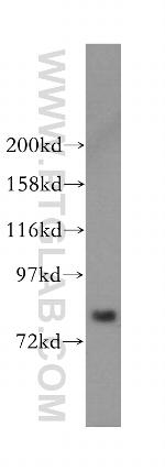 MDM1 Antibody in Western Blot (WB)
