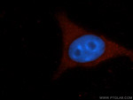 Icam-1 Antibody in Immunocytochemistry (ICC/IF)