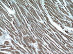 MYPN Antibody in Immunohistochemistry (Paraffin) (IHC (P))