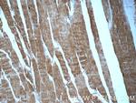 MYPN Antibody in Immunohistochemistry (Paraffin) (IHC (P))
