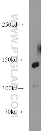 MYPN Antibody in Western Blot (WB)