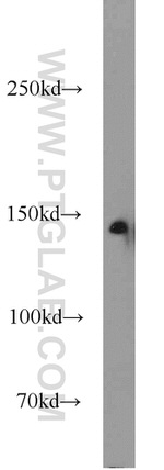 MYPN Antibody in Western Blot (WB)