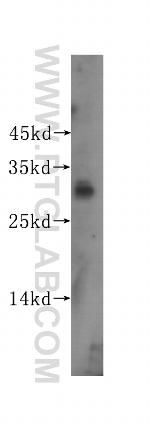 ING1 Antibody in Western Blot (WB)